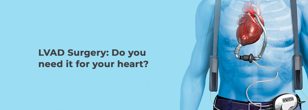 LVAD Surgery: Do you need it for your heart?